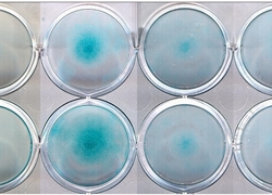 Normal_alcian_stain_micromass