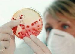 Normal_normal_onderzoek_kweek_virus_bacterie