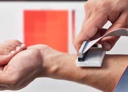sKan, winnende uitvinding van de James Dyson Award 2017 sKan, winnende uitvinding van de James Dyson Award 2017
