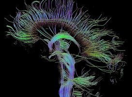 Art of Neuroscience 2020 open voor inzendingen