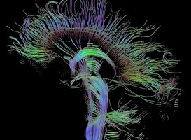 Art of Neuroscience 2020 open voor inzendingen Art of Neuroscience 2020 open voor inzendingen
