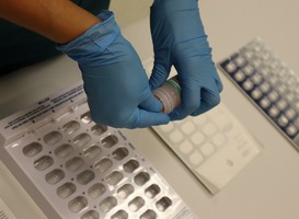 Minder bijwerkingen medicatie vanwege het testen op DNA Minder bijwerkingen medicatie vanwege het testen op DNA