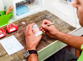 Normal_dentist-preparing-artificial-teeth-with-a-special-2023-01-21-00-22-02-utc