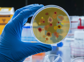 Normal_scientist-examines-malaria-virus-on-petri-dish-in-2021-09-01-21-09-52-utc