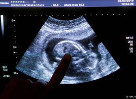 'Debat over wetenschappelijk onderzoek naar embryo's is nodig'