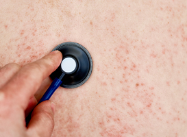 Normal_allergic-rash-on-skin-woman-with-dermatology-prob-2025-03-15-01-04-31-utc