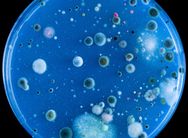 Studenten in de Randstad besmet met MRSA-bacterie Studenten in de Randstad besmet met MRSA-bacterie