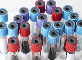 Vanaf oktober nieuwe transfusiegeneeskundemaster bij LEI